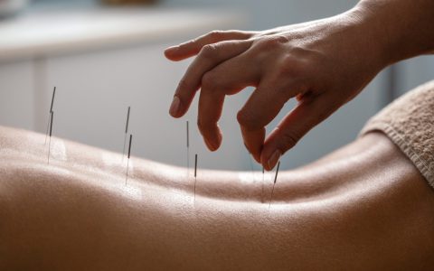 Acupuntura: Un Camino Natural hacia el Bienestar y la Salud Integral